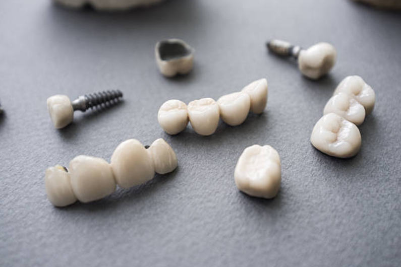 ceramic-injection-molding-dental-implants